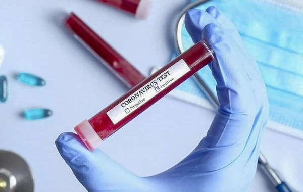 Azərbaycanda aparılmış koronavirus testlərinin sayı 310 minə yaxınlaşır