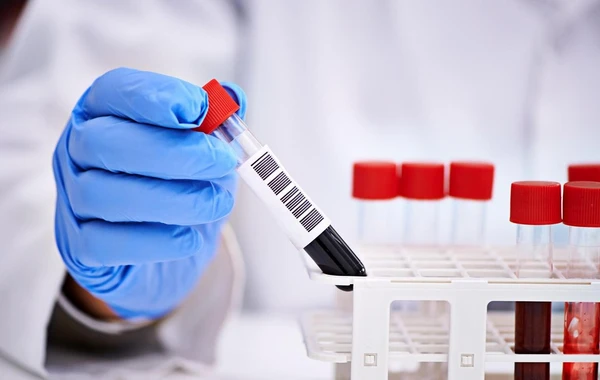 Azərbaycanda icra başçısının müavini və xanımı koronavirusa yoluxdu