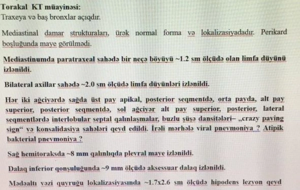 Ev şəraitində COVID-19-dan sağalan Səbinə: “Tam ciddi öləcəyimi düşünürdüm..."