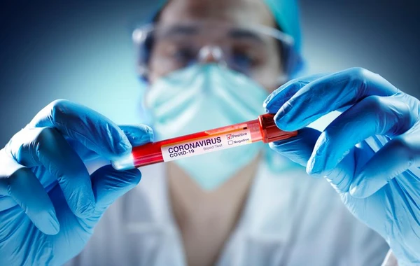 Koronavirusun müəyyənləşdirilməsi üçün testlərin müsbət və mənfi tərəfləri açıqlandı