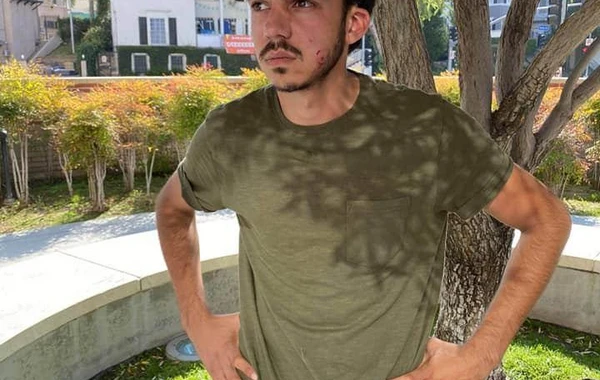Xaricdə ermənilər 40 soydaşımızı yaralayıb - FOTO