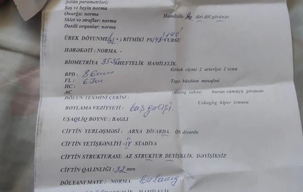 Bakıda yeni doğulan əkizlərdən biri xəstəxanada satılıb? – RƏSMİ AÇIQLAMA