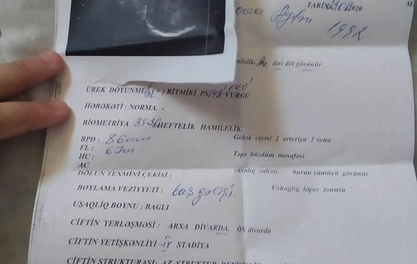 Bakıda yeni doğulan əkizlərdən biri xəstəxanada satılıb? – RƏSMİ AÇIQLAMA