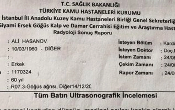Əli Həsənov Abu-Dabiyə getməyə hazırlaşır - FOTO