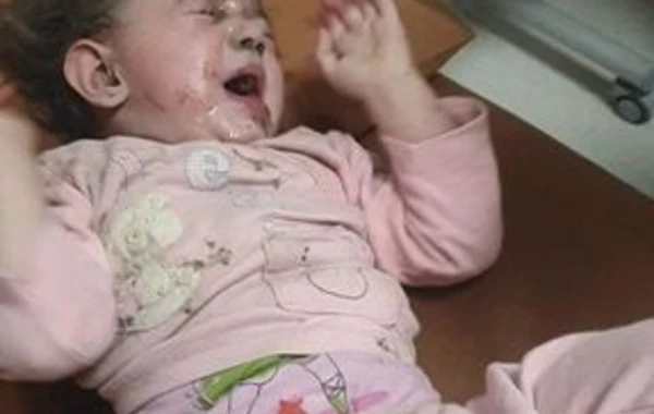 Среди пострадавших в результате вражеского обстрела Гянджи есть малолетние дети – ВИДЕО