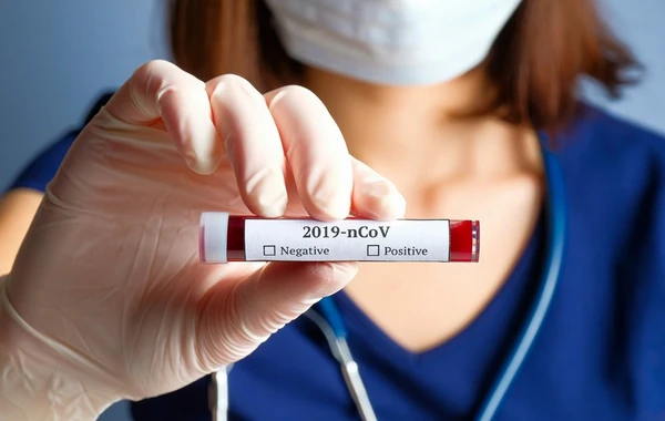Daha 52 şagirddə koronavirus aşkarlanıb