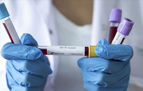 Azərbaycanda koronavirusa yoluxanların sayı açıqlandı