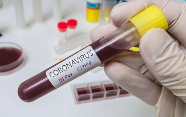 Ermənistanda koronavirus tüğyan edir