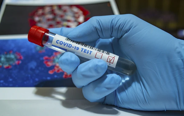 Azərbaycanda bu gün koronavirusa yoluxanların sayı açıqlandı