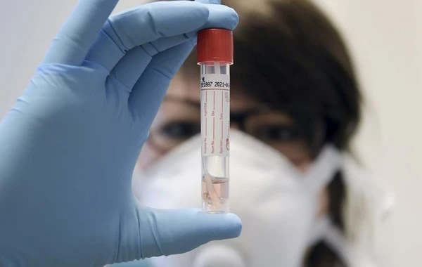 Azərbaycanda simptomsuz təmaslılardan koronavirus testi götürülməsinə müvəqqəti məhdudiyyət qoyulub