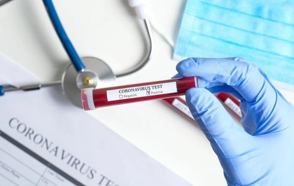 Mağazada satıcı işləyən şəxsdə koronavirus aşkarlandı