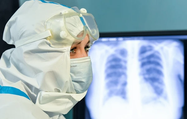 Buzlu şüşə diaqnozu qoyulan koronavirus xəstələri nə etməlidir? - Həkimdən açıqlama