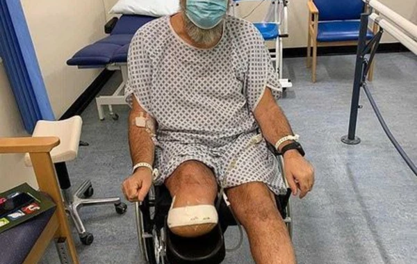 Sağlam kişi koronavirusa yoluxduqdan sonra ayağını itirdi - FOTO