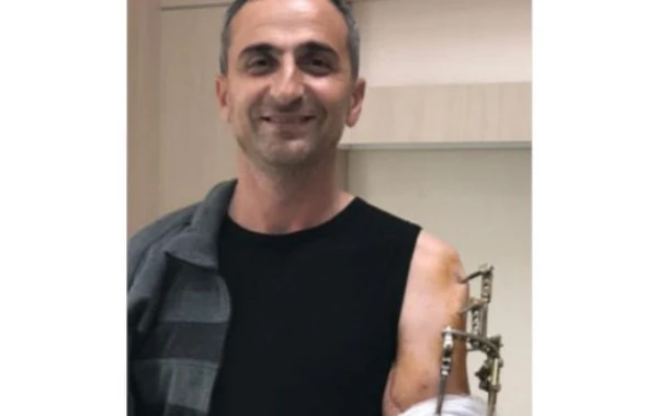 “Əyilib sağ əlimlə yerdən qolumu götürdüm və uzaqlaşdım” - FOTO