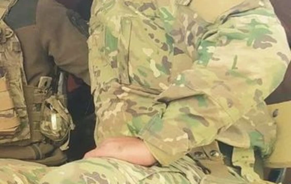 Vətən müharibəsinin “Canavar” ləqəbli həkimi: “Möhtəşəm taktikayla düşdüyümüz vəziyyətdən çıxdıq” - FOTO
