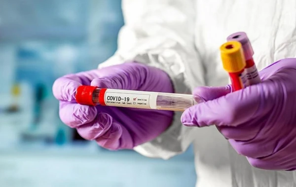 Выявлено заболевание, повышающее риск смерти от COVID-19 почти в три раза