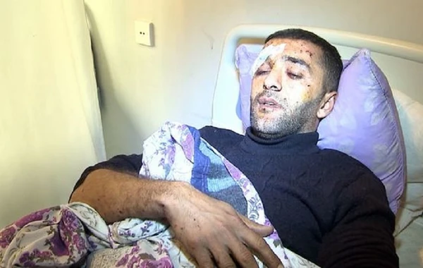 Tərtərdə minaya düşən traktorçu: “Əlim, üzüm qan içində idi” - VİDEO