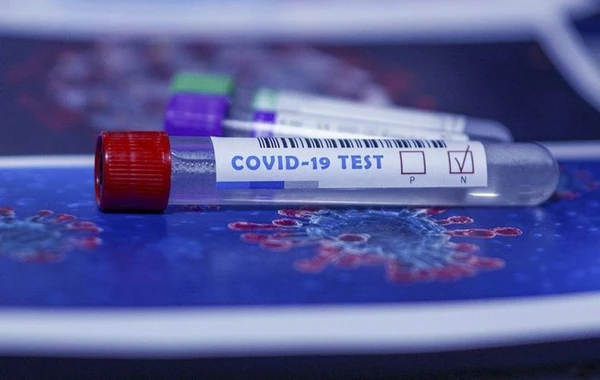 Ölkə üzrə COVID-19-a yoluxma statistikası açıqlanıb