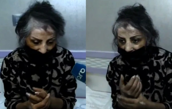 Zöhrə Abdullayeva xəstəxanaya yerləşdirilib - FOTO