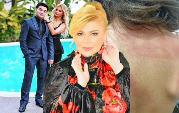 Mətanət İsgəndərlinin gəlini kirayə qaldığı evdən qovuldu: “Dörd ev, dörd maşını var”