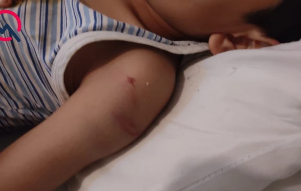 Azərbaycanda anadan vəhşilik - Sevgilisi ilə birləşərək 7 yaşlı oğlunu... - VİDEO