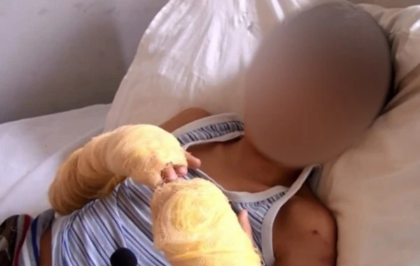 Bərdədə uşağın əllərini yandıran ana barədə cinayət işi açıldı