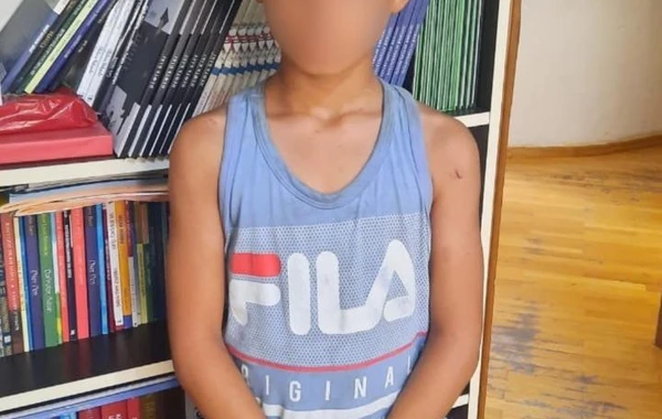 Bakıda tükürpədən hadisə: Qohumları azyaşlını döyərək dilənməyə məcbur ediblər - FOTO