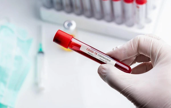 Səhiyyə Nazirliyi koronavirus testləri ilə bağlı narazılıqlara münasibət bildirib