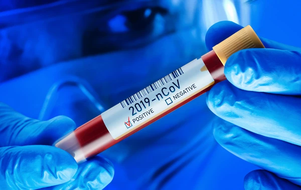 Azərbaycanda koronavirusa yoluxanların bu günə olan statistikası açıqlandı