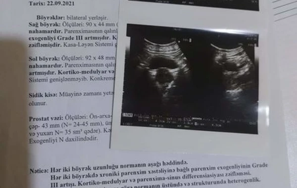 41 yaşlı Fəridin sizin köməyinizə ehtiyacı var - FOTO