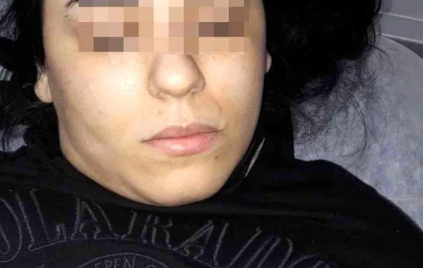 Polis əxlaqsızlıq yuvasına basqın etdi, azərbaycanlı qadının ayağı sındı - VİDEO