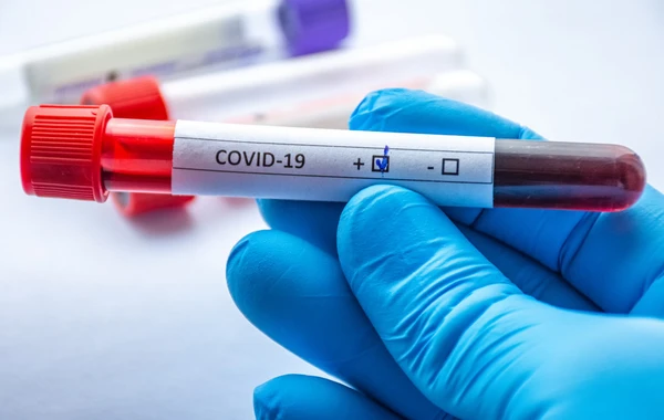 Опубликована суточная статистика по заболеваемости коронавирусом в Азербайджане - ФОТО