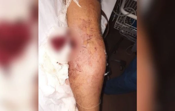 Ermənilərin açdığı atəş nəticəsində “Azercell”in əməkdaşı yaralandı – FOTO
