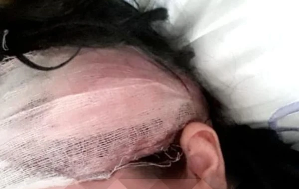 15 yaşında ərə verilən qız həyat yoldaşı və qayınanası tərəfindən döyülürmüş - FOTO