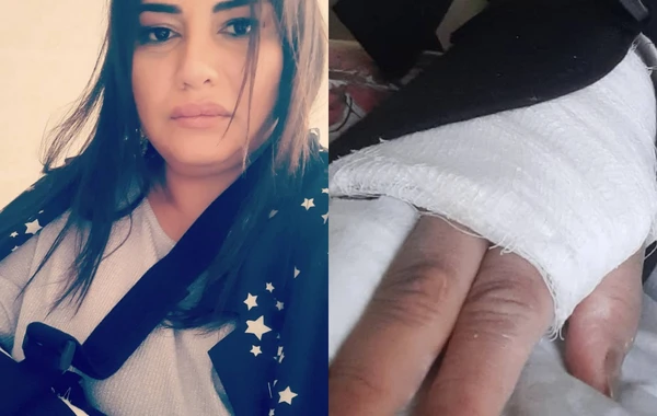 Azərbaycanlı aparıcının qolu sındı: "Ağrıkəsici olmadan mümkün deyil" - FOTO