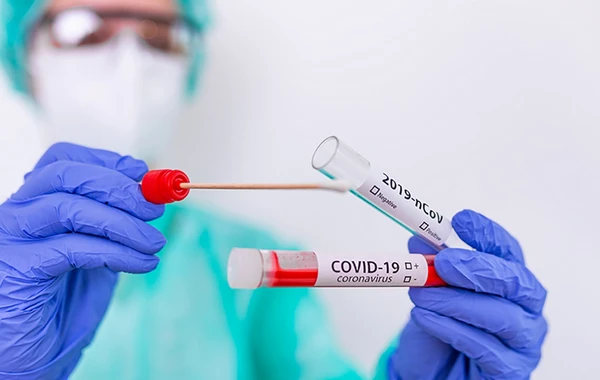 В Азербайджане резко выросло число заболевших COVID-19 - ФОТО