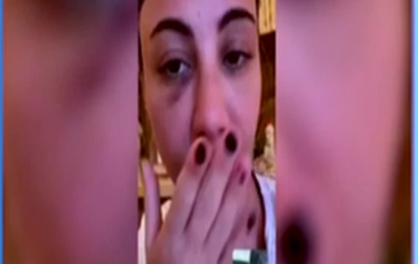 Aysel Əlizadə avtomobil qəzası keçirdi - FOTO/VİDEO