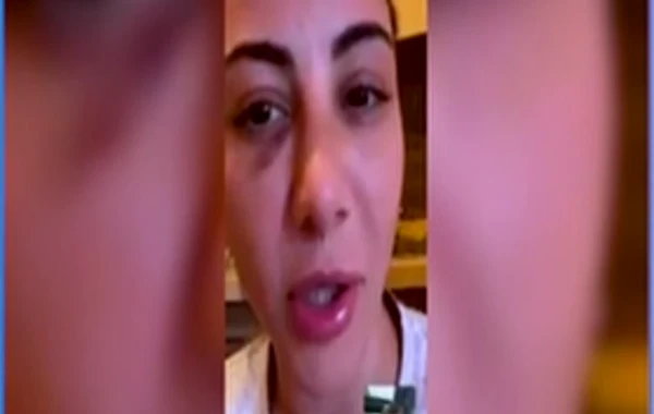 Aysel Əlizadə avtomobil qəzası keçirdi - FOTO/VİDEO