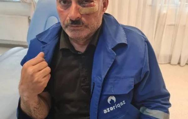 Borclu abonent yaba ilə “Azəriqaz”ın işçilərini HƏDƏLƏDİ: Birini yaraladı - FOTO