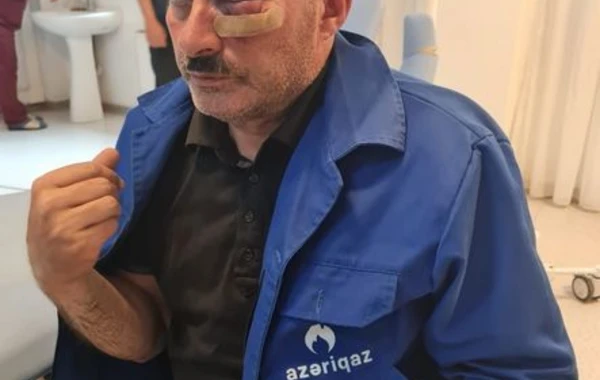 Borclu abonent yaba ilə “Azəriqaz”ın işçilərini HƏDƏLƏDİ: Birini yaraladı - FOTO