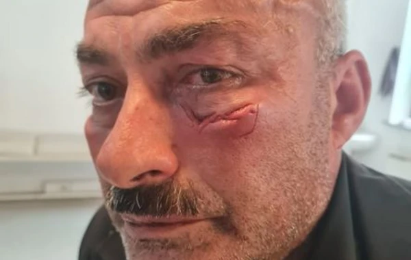 Borclu abonent yaba ilə “Azəriqaz”ın işçilərini HƏDƏLƏDİ: Birini yaraladı - FOTO
