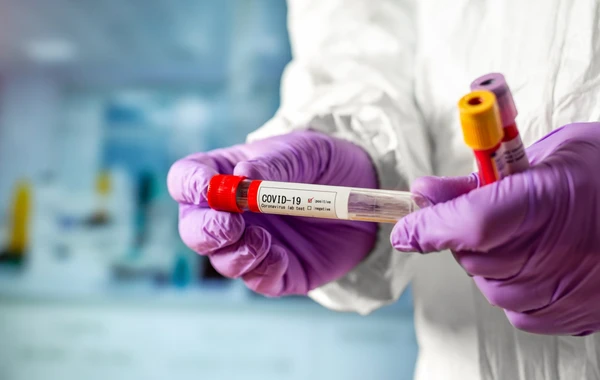 В Азербайджане еще 11 человек заразились коронавирусом