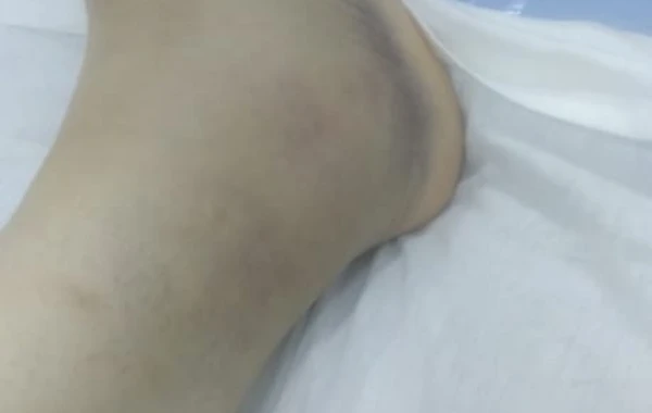 В Баку мужчина ранил ножом пожелавшую развестись с ним супругу - ФОТО