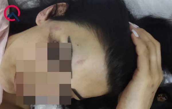 В Баку мужчина ранил ножом пожелавшую развестись с ним супругу - ФОТО