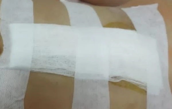 В Баку мужчина ранил ножом пожелавшую развестись с ним супругу - ФОТО