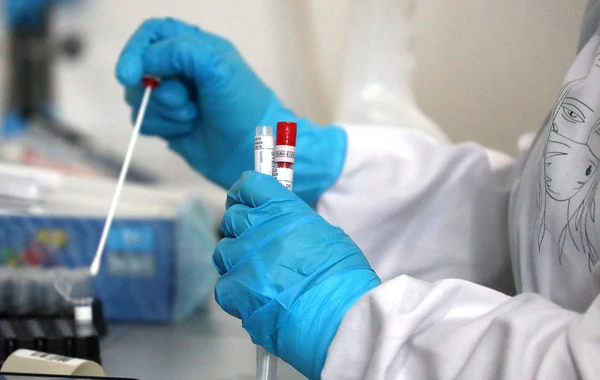Azərbaycanda son sutkada koronavirusa yoluxanların statistikası