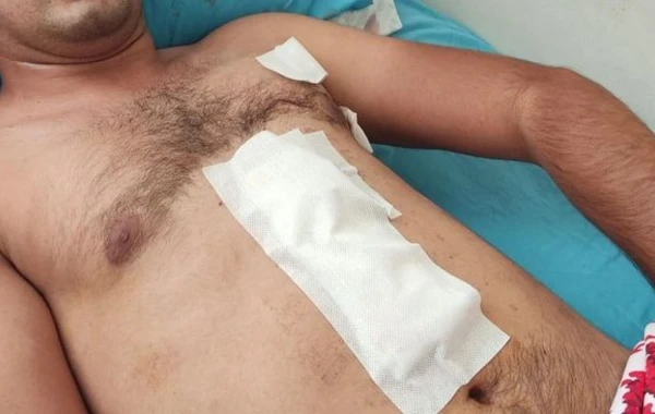 Qazi polislərin gözü qarşısında bıçaqlandı - FOTO