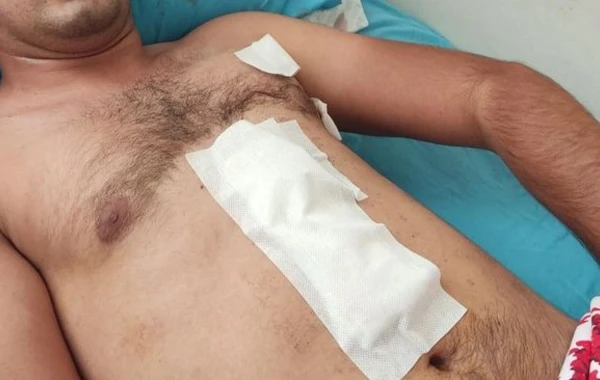 В Агдаме ветерана Отечественной войны ударили ножом на глазах у полицейских - ФОТО