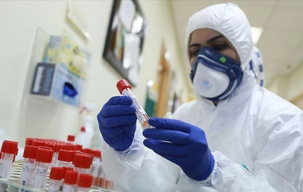 Azərbaycanda son sutkada 32 nəfər koronavirusa yoluxub
