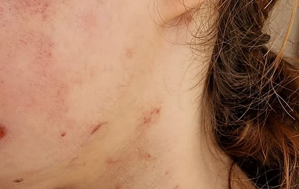 İcra başçısının müavini tərəfindən döyüldüyü deyilən yeniyetmə qızın anası DANIŞDI - YENİLƏNİB - FOTO
